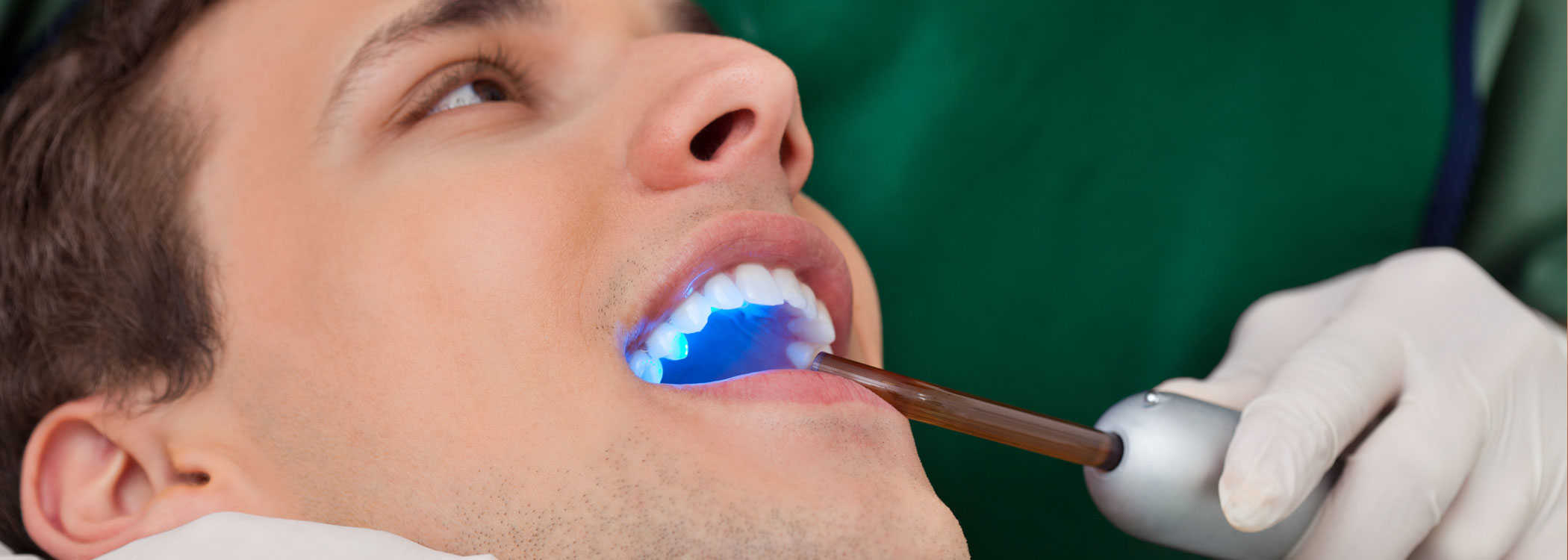 Dental cleaning on a young man with UV light.