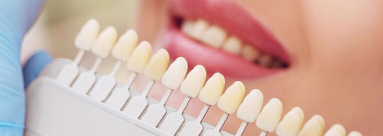 Dental implants - Color samples.