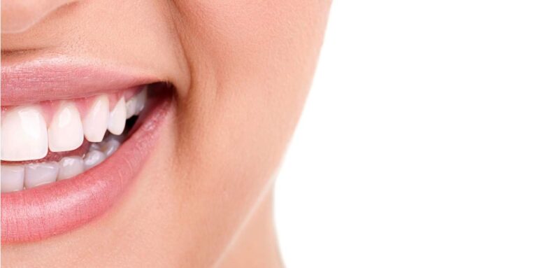 Improve Your Smile - Image of left side of woman's face.