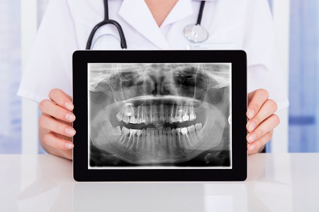 Digital dental x-ray being held by dental professional.