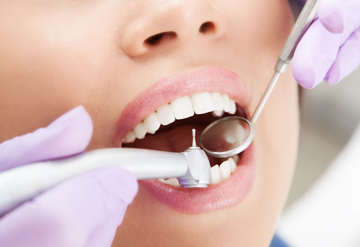 Dental exam of Young Woman showing Mirror & Cleaning tool.
