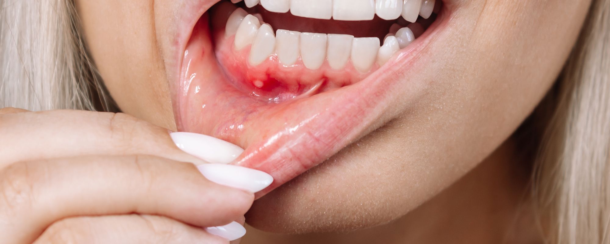 gum disease