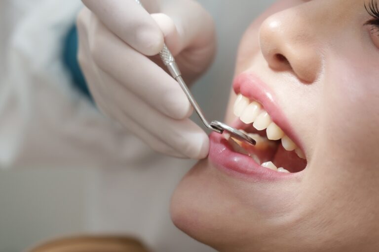 From Start to Finish: Understanding Your Dental Cleaning in Fergus